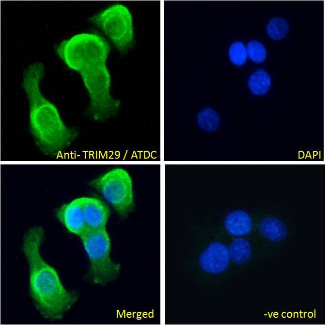 IHC-plus™ TRIM29 Antibody (aa295-306)