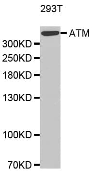 Polyclonal Rabbit anti-Human ATM Antibody (IF, WB)