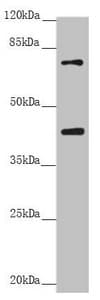 RACGAP1 / MGCRACGAP Antibody