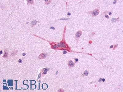 PathPlus™ Polyclonal Rabbit anti-Human ADGRE5 / CD97 Antibody (Cytoplasmic Domain, IHC)