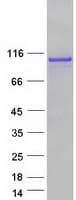 Human CTNNB1 / Beta Catenin Protein (Recombinant Myc-DDK (Flag))