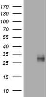 CD99 Antibody (clone OTI2H6)