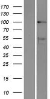 DDX10 Protein (Over-Expression Lysate Myc-DDK (Flag))