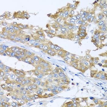 Polyclonal Rabbit anti-Human COQ7 Antibody (IHC, WB)