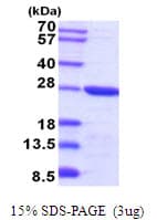 Mouse TPT1 / TCTP Protein (Recombinant His)