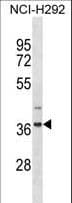 ZNF696 Antibody (aa1-30)