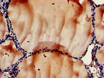 RPS6KA5 / MSK1 Antibody
