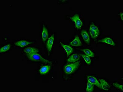 CTSA / Cathepsin A Antibody
