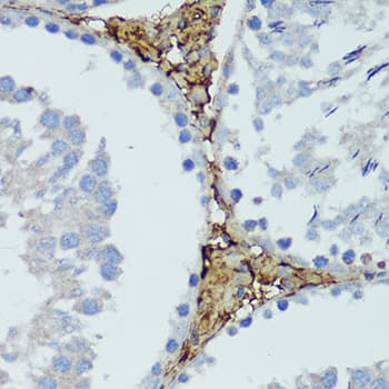 Polyclonal Rabbit anti-Human HTRA3 Antibody (IHC, WB)