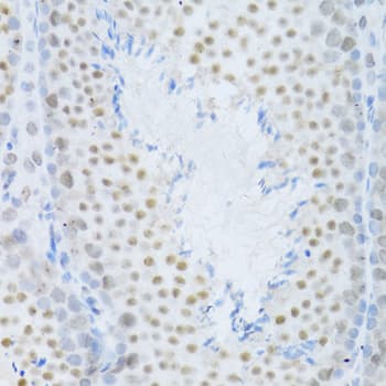 Polyclonal Rabbit anti-Human MAPK3 / ERK1 Antibody (IHC, IF, WB)