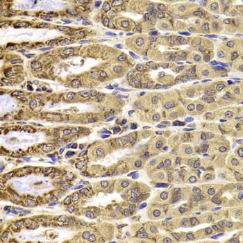 CMPK / CMPK1 Antibody