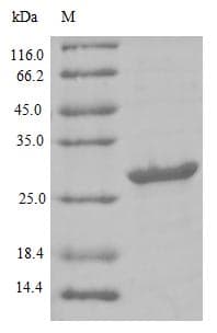 Human LY6G6D Protein (Recombinant 10His-B2M, N-terminus)
