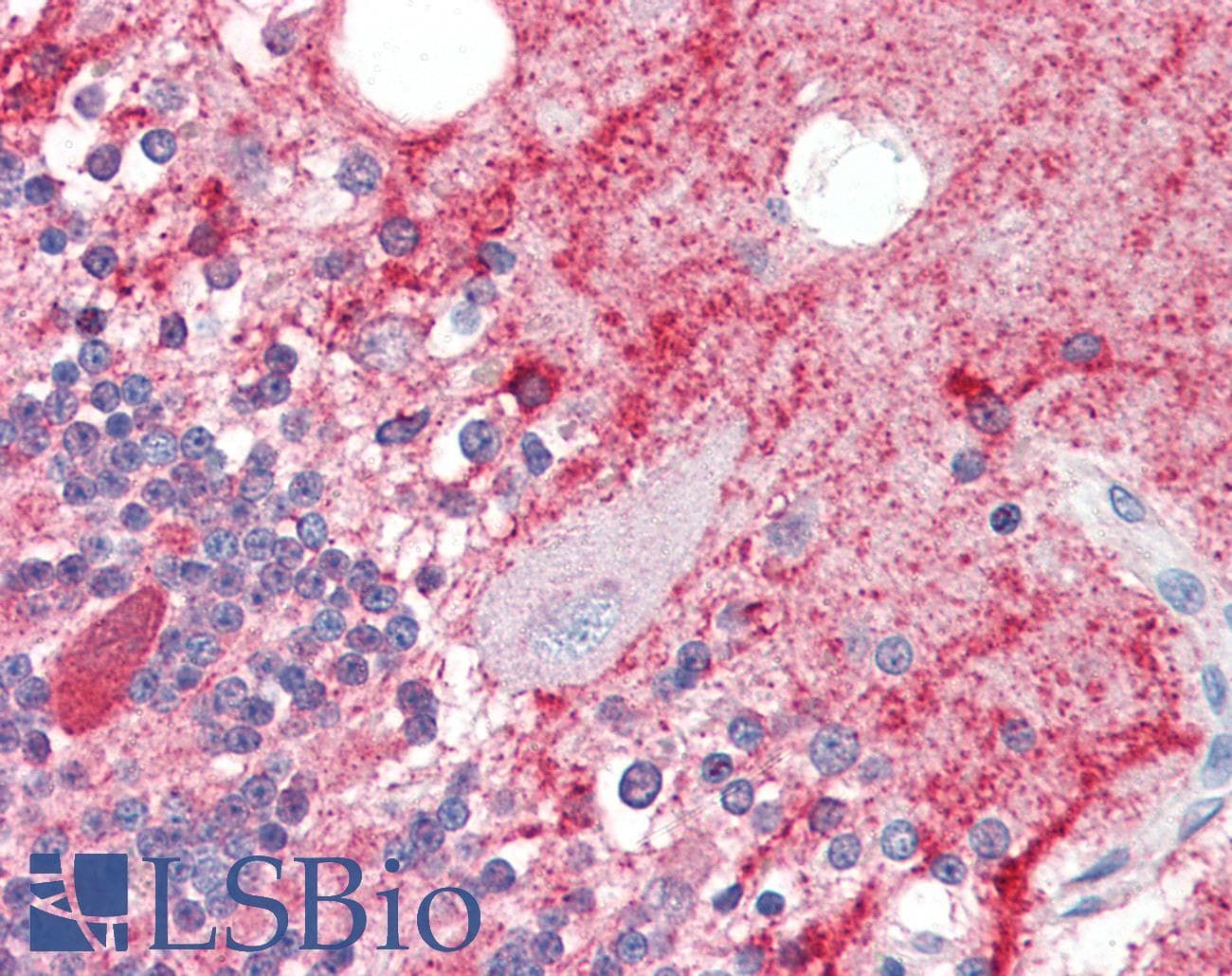 IHC-plus™ Polyclonal Rabbit anti-Human SLITRK1 Antibody (IHC, IF, WB)