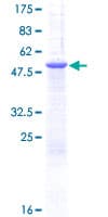 Human PGRMC1 / MPR Protein (Recombinant GST)