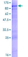 Human RHPN2 Protein (Recombinant GST)