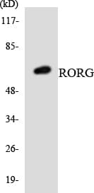 Polyclonal Rabbit anti-Human RORC / ROR Gamma Antibody (aa55-104, WB)
