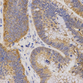 P2RY11 / P2Y11 Antibody