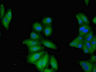 Polyclonal Rabbit anti-Human TNFAIP1 Antibody (IHC, IF)