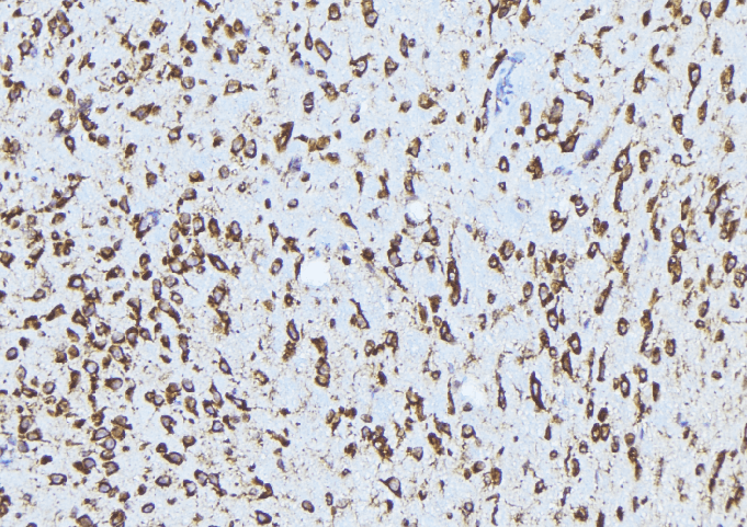 ADAM12 Antibody