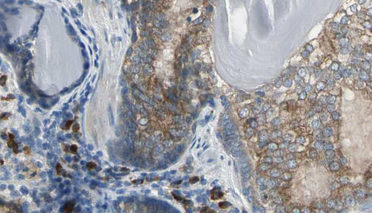 AK1 / Adenylate Kinase 1 Antibody