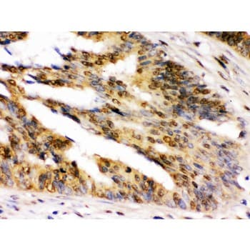 NIRF / UHRF2 Antibody (aa15-54)