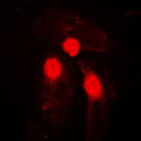 SMAD3 Antibody (phospho-Ser204)