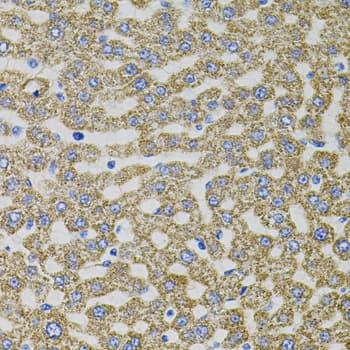 EPO / Erythropoietin Antibody