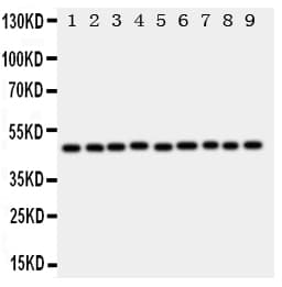 Polyclonal Rabbit anti-Human E2F2 Antibody (aa422-427, WB)