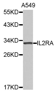 IHC-plus™ IL2RA / CD25 Antibody