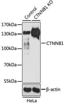 Polyclonal Rabbit anti-Human CTNNB1 / Beta Catenin Antibody (IHC, WB)
