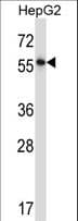 IHC-plus™ NFIA / Nuclear Factor 1 Antibody (aa470-498)