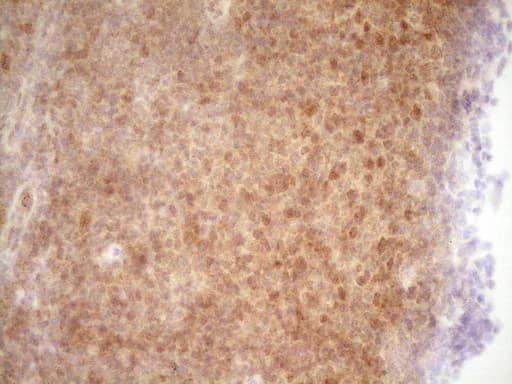 Monoclonal Mouse anti-Human TRB3 / TRIB3 Antibody (clone OTI3C6, aa1-200, IHC, WB)