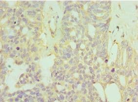 HYAL1 Antibody (aa136-435)
