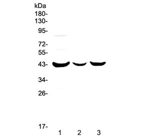 Polyclonal Rabbit anti-Human LPAR6 / P2RY5 / P2Y5 Antibody (WB)