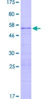 Human RPL13 / Ribosomal Protein L13 (Recombinant GST)