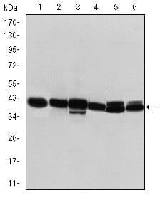 KRT19 / CK19 / Cytokeratin 19 Antibody (clone 1H6)