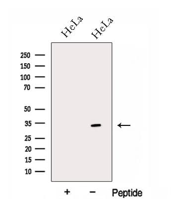 Polyclonal Rabbit anti-Human GNPDA1 Antibody (WB)