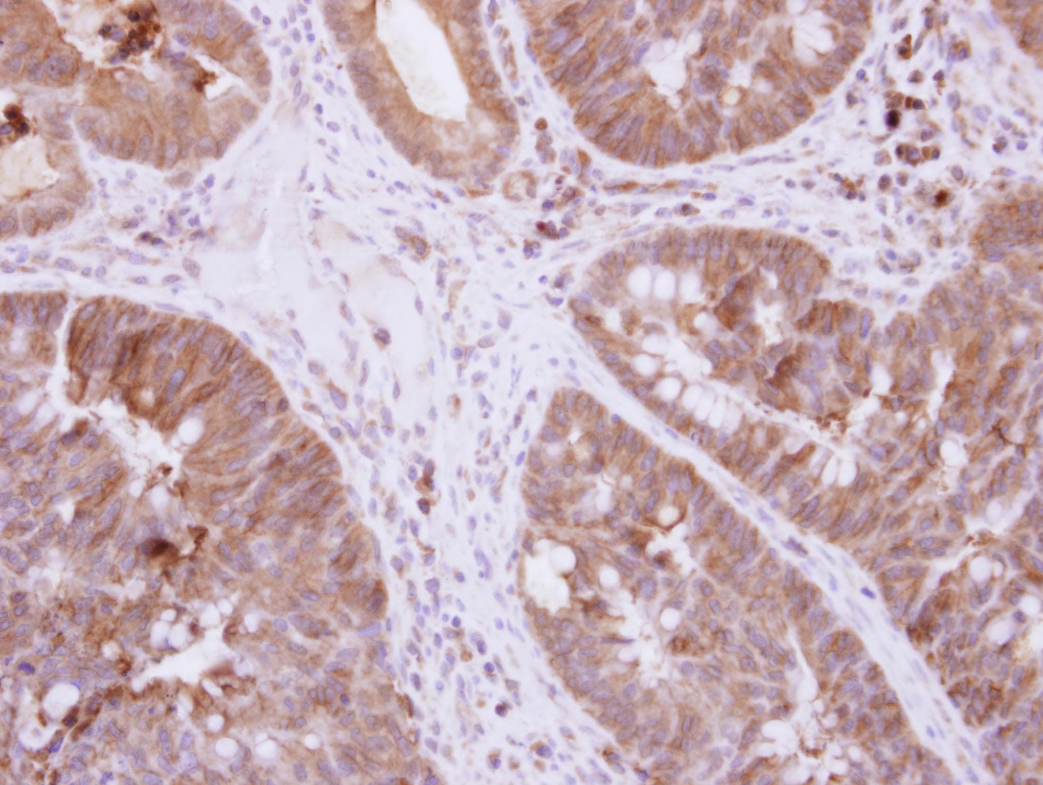 Polyclonal Rabbit anti-Human DIS3L2 Antibody (Internal, IHC, WB)