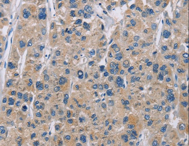 NME5 Antibody