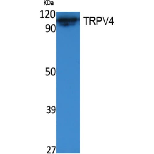 TRPV4 Antibody (Internal)