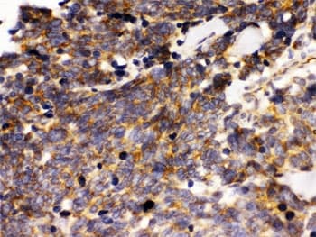PTPRF Antibody