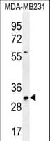 TNFAIP8L3 Antibody (aa136-164)