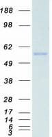 Human CYP2E1 Protein (Recombinant Myc-DDK (Flag))
