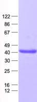 Human ZC3H8 Protein (Recombinant His, N-Terminal)