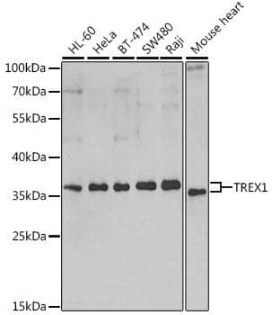 Polyclonal Rabbit anti-Human TREX1 Antibody (IF, WB)
