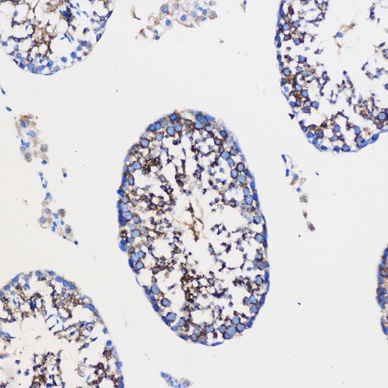 NOTCH1 Antibody