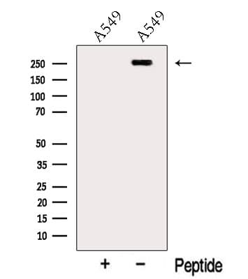MYOF / Myoferlin Antibody