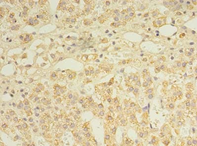 Polyclonal Rabbit anti-Human FDXR Antibody (IHC, WB)