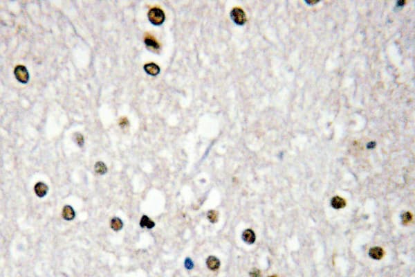 TP73 / p73 Antibody (Pro298)