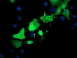 TSC22D3 / GILZ Antibody (clone OTI1E11)